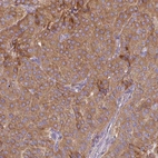 Immunohistochemical staining of human parathyroid gland shows high expression.