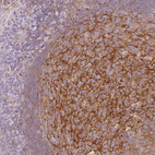 Immunohistochemical staining of human lymphoid tissues shows moderate positivity in reticular fibers in germinal center cells.