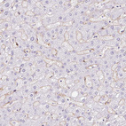 Immunohistochemical staining of human liver shows moderate membranous positivity in hepatic sinusoid cells.