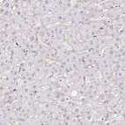 Immunohistochemical staining of human liver shows moderate membranous positivity in hepatic sinusoid cells.