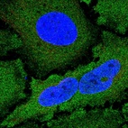 Anti-NCKIPSD Antibody