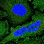 Immunofluorescent staining of human cell line HeLa shows localization to plasma membrane & cytosol.