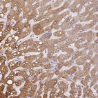 Immunohistochemical staining of human liver shows strong granular cytoplasmic positivity in hepatocytes.