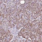 Immunohistochemical staining of human pancreas shows strong granular cytoplasmic positivity in exocrine glandular cells.