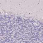 Immunohistochemical staining of human cerebellum shows no positivity as expected.