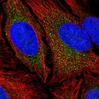 Immunofluorescent staining of human cell line HeLa shows localization to vesicles.