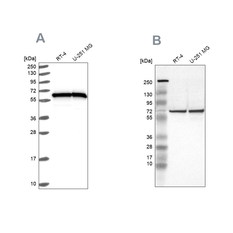 Anti-HSPD1 Antibody
