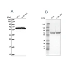 Anti-HSPD1 Antibody