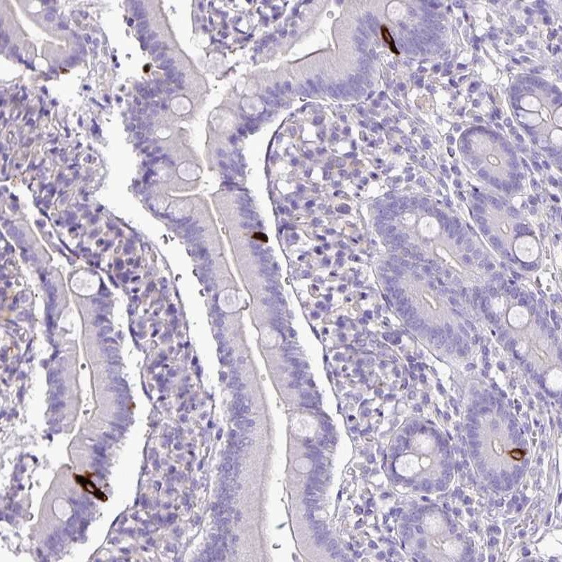 Anti-ZNF334 Antibody