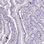 Anti-ZNF334 Antibody