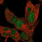 Immunofluorescent staining of human cell line SH-SY5Y shows localization to nucleus & cytosol.