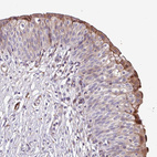 Immunohistochemical staining of human urinary bladder shows moderate cytoplasmic positivity in a subset of urothelial cells.