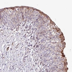 Immunohistochemical staining of human urinary bladder shows moderate cytoplasmic positivity in a subset of urothelial cells.