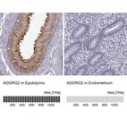 Anti-ADGRG2 Antibody