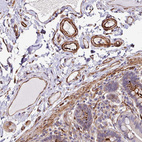 Immunohistochemical staining of human colon shows moderate to strong cytoplasmic positivity in endothelial cells.