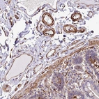 Immunohistochemical staining of human colon shows moderate to strong cytoplasmic positivity in endothelial cells.