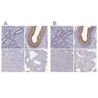 Immunohistochemical staining of human endometrium, epididymis, liver and skeletal muscle using Anti-ADGRG2 antibody HPA050029 (A) shows similar protein distribution across tissues to independent antibody HPA001478 (B).