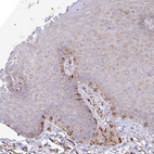 Immunohistochemical staining of human skin shows moderate cytoplasmic positivity in a subset of squamous epithelial cells.