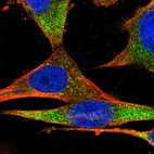 Immunofluorescent staining of human cell line U-251 MG shows localization to cytosol.