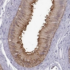 Immunohistochemical staining of human epididymis shows strong positivity in microvilli in glandular cells.