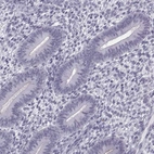 Immunohistochemical staining of human endometrium shows no positivity in glandular cells as expected.