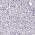 Anti-ADGRG2 Antibody