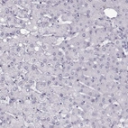 Immunohistochemical staining of human liver shows no positivity in hepatocytes as expected.