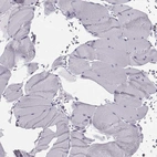 Immunohistochemical staining of human skeletal muscle shows no positivity in myocytes as expected.