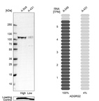 Anti-ADGRG2 Antibody