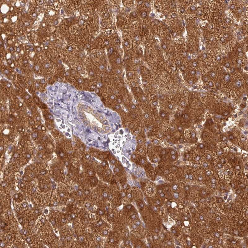 Anti-MTHFD1 Antibody