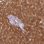 Anti-MTHFD1 Antibody