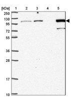 Lane 1: Marker [kDa] 250, 130, 95, 72, 55, 36, 28, 17, 10_br/_Lane 2: Human cell line RT-4_br/_Lane 3: Human cell line U-251 MG_br/_Lane 4: Human plasma_br/_Lane 5: Human Liver tissue