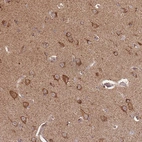 Immunohistochemical staining of human Cerebral cortex shows moderate granular cytoplasmic positivity in neuronal cells.