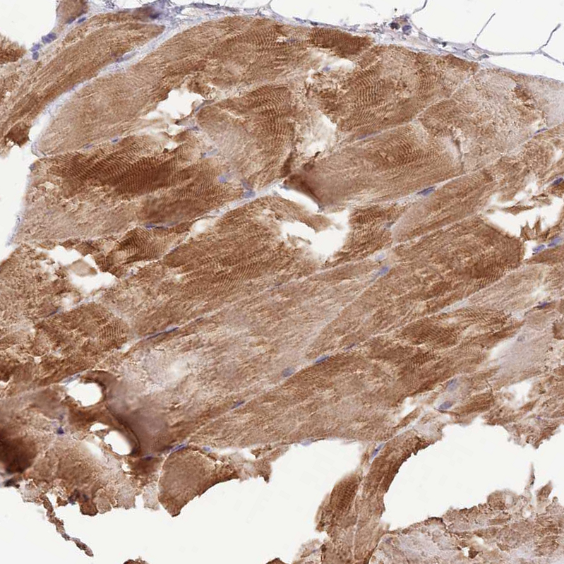 Anti-TRIM32 Antibody