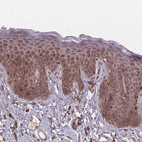 Immunohistochemical staining of human Skin shows moderate granular cytoplasmic positivity in squamous epithelial cells.