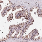 Immunohistochemical staining of human prostate shows strong nuclear positivity in glandular cells.