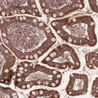 Immunohistochemical staining of human Small intestine shows moderate granular cytoplasmic positivity in glandular cells.