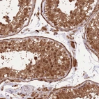 Immunohistochemical staining of human testis shows strong nuclear and cytoplasmic positivity in cells in seminiferous ducts.