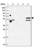 Lane 1: Marker [kDa] 250, 130, 95, 72, 55, 36, 28, 17, 10_br/_Lane 2: Human cell line RT-4_br/_Lane 3: Human cell line U-251MG sp_br/_Lane 4: Human plasma (IgG/HSA depleted)_br/_Lane 5: Human liver tissue