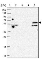Lane 1: Marker [kDa] 250, 130, 95, 72, 55, 36, 28, 17, 10_br/_Lane 2: Human cell line RT-4_br/_Lane 3: Human cell line U-251MG sp_br/_Lane 4: Human plasma (IgG/HSA depleted)_br/_Lane 5: Human liver tissue