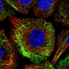 Immunofluorescent staining of human cell line A-431 shows localization to intermediate filaments.