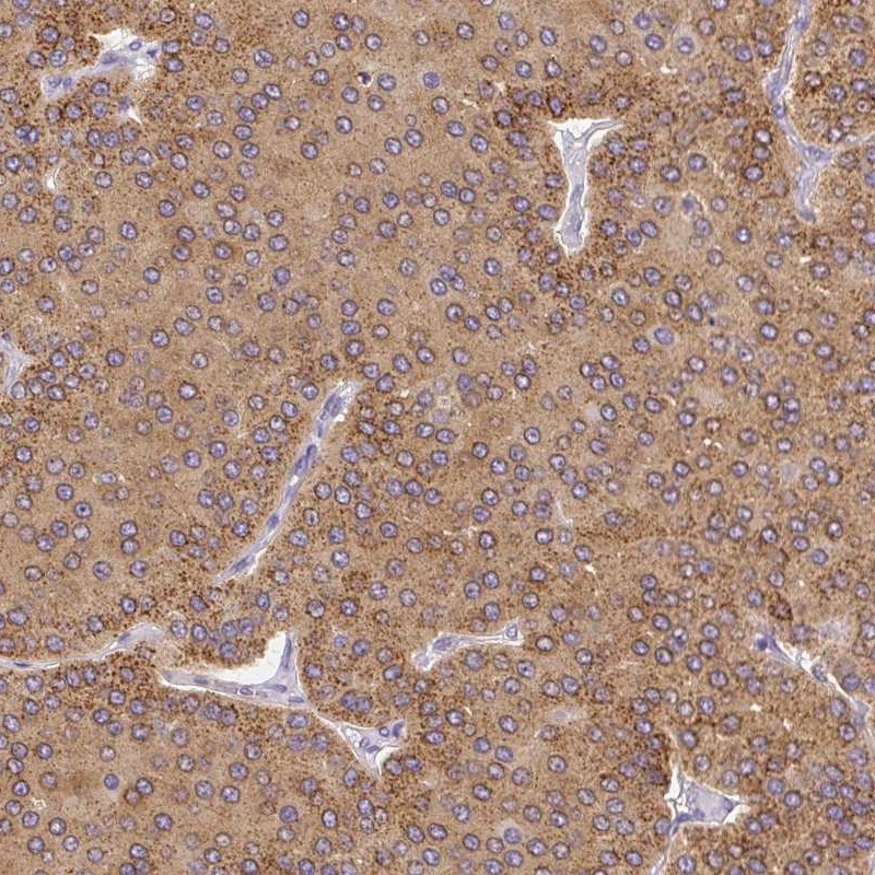 Rabbit Polyclonal AntiPLA2G4A Antibody Buy for research Highly
