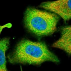 Immunofluorescent staining of human cell line A549 shows localization to cytosol.