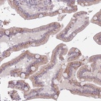 Anti-ZNF576 Antibody