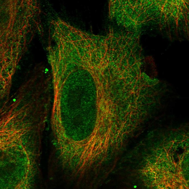 Anti-TEX13C Antibody