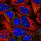 Immunofluorescent staining of human cell line CACO-2 shows localization to nucleoli fibrillar center & peroxisomes.