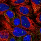 Immunofluorescent staining of human cell line CACO-2 shows localization to nucleoli fibrillar center & peroxisomes.