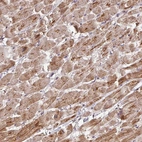 Anti-MRPS16 Antibody
