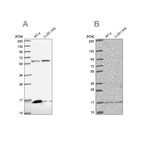 Western blot analysis using Anti-MRPS16 antibody HPA050081 (A) shows similar pattern to independent antibody HPA054538 (B).