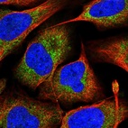 Immunofluorescent staining of human cell line U-2 OS shows localization to cytosol & mitochondria.